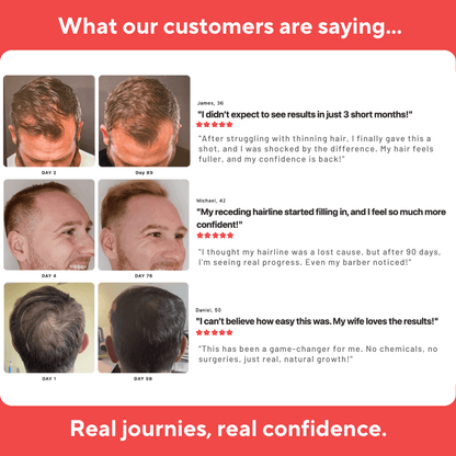 LuxLid™ Hair Grow Pro